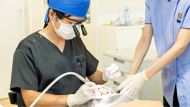 負担が少ないエアフローのクリーニングもおすすめ