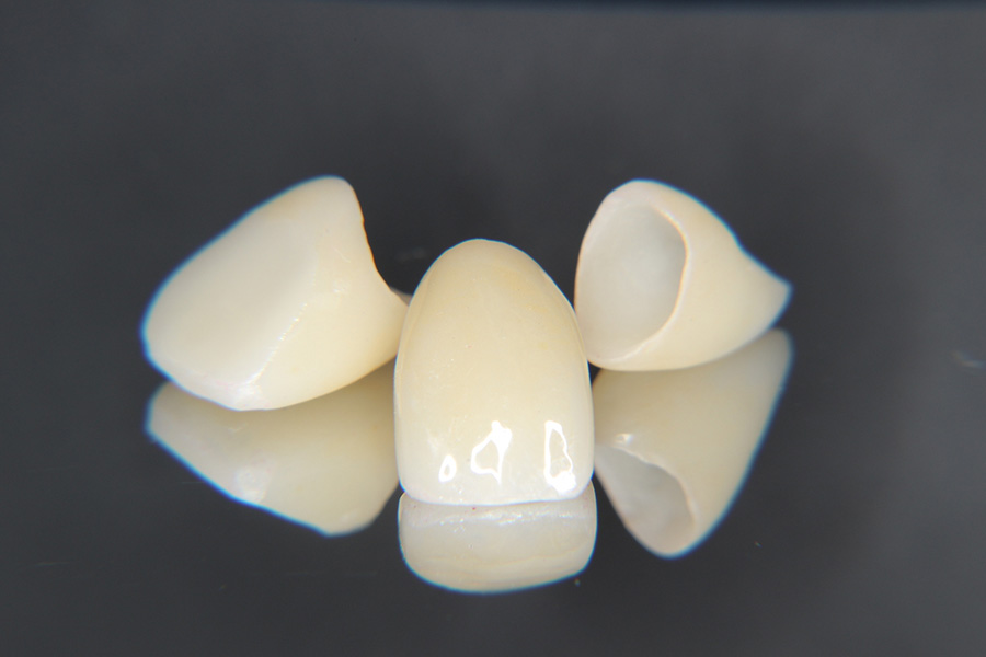 セラミックを長持ちさせるために