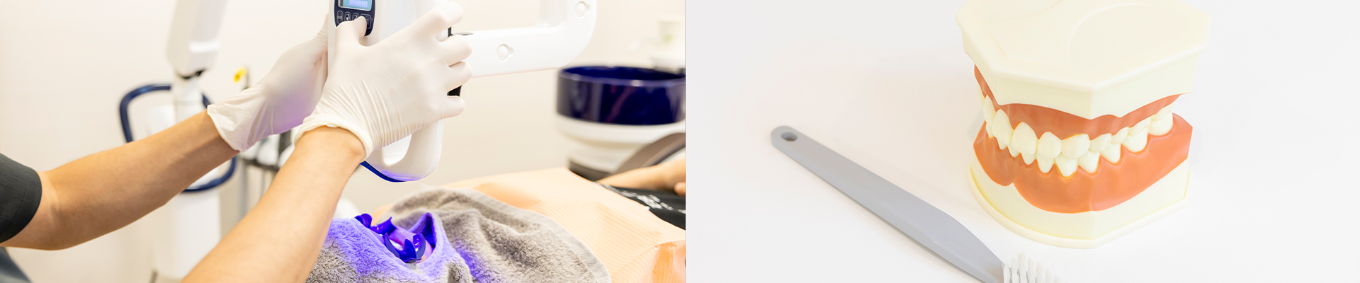 ホワイトニング