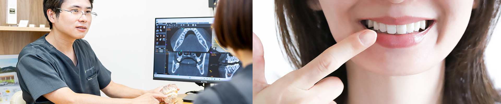 審美治療（セラミック）